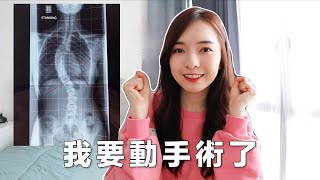 【脊椎側彎】我決定動手術了 Scoliosis Surgery ｜Stephy Yiwen [upl. by Onra391]