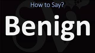 How to Pronounce Benign CORRECTLY [upl. by Gildus]