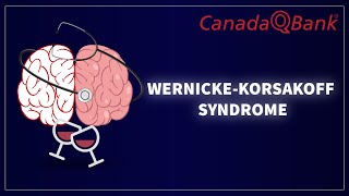 Wernicke Korsakoff Syndrome [upl. by Whall696]