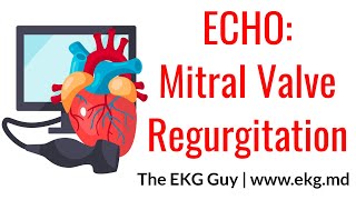 Mitral Valve Regurgitation  ECHO Course l The EKG Guy  wwwekgmd [upl. by Dlorej]