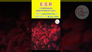 What is ESR test  Erythrocyte sedimentation rate test shorts ESR bloodtest [upl. by Aaronson]