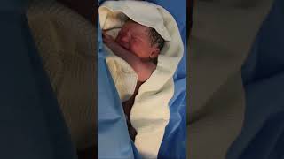 My chubby newborn baby weighing 7 kg a few minutes after birth [upl. by Eamon]