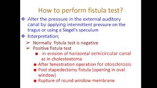 Fistula test and Henneberts sign [upl. by Fabyola727]