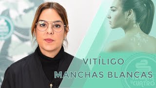 Manchas blancas en la piel VitÃ­ligo [upl. by Alithia]