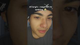 Im allergic to everything allergies story storytime entertainment duet funny comedyvideo [upl. by Aiuoqes]