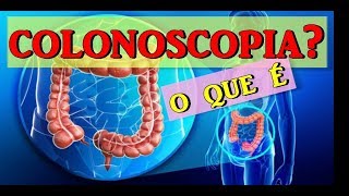 🔴COLONOSCOPIA  COMO É FEITO O EXAME E PARA QUE SERVE [upl. by Amliw]