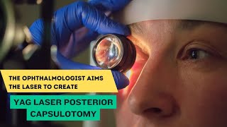 YAG Laser Posterior Capsulotomy [upl. by Judus740]