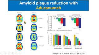 傅中玲 教授，PET biomarkers for amyloid pathology in Alzheimer’s disease [upl. by Furtek]