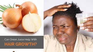 Onion Juice For Hair Growth  Does It Really Work [upl. by Dlawso177]