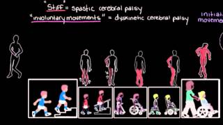 Khan Academy  Types of Cerebral Palsy Part 2 Dyskinetic amp Ataxic [upl. by Krueger]