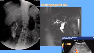 Wybrane zagadnienia z anatomii radiologicznej jamy brzusznej  dr n med Paweł Szaro [upl. by Alek]