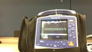 Synchronized Cardioversion with Propaq MD [upl. by Ker]