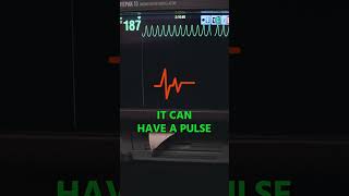 Ventricular Tachycardia EMS Call [upl. by Enellek392]