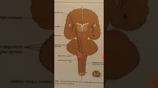 Descending tracts Rubrospinal tractolivospinal tractreticulospinal tractvestibulospinal Tract [upl. by Christiano]