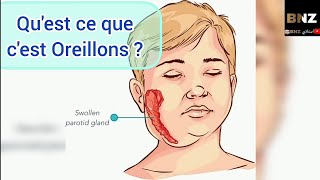 Oreillons  définition  Transmission  Complication  Symptômes et Traitement 😀 [upl. by Artair767]