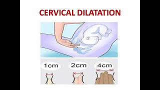 CERVICAL DILATATION [upl. by Reilly]