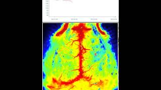 Needle induced Cortical Spreading Depression  laser speckle imaging [upl. by Terryl75]