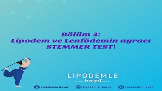 Bölüm 3 Lipödem ve lenfödemin ayracı stemmer testi [upl. by Ailekat399]