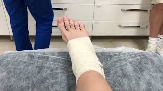 Sprained Ankle Twisted Ankle Rolled Ankle 2 Hours After Accident Fixing With Bandage Turkey ED [upl. by Templeton540]