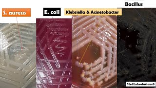 Most Common Bacterial Colony Morphology E coliKlebsiellaPseudomonasProteusStaphylococcusBaci [upl. by Fisher]