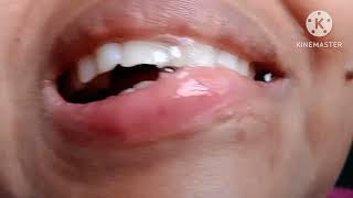 lip biting challenge  with saliva without lipstick friends most request video [upl. by Yelhak]