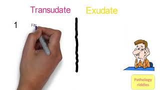 Edema Pathology Part  3 Hemodynamics Transudate versus Exudate Fmge Neet PG usmle Pathology Notes [upl. by Atalanta]