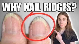 Why You Have Vertical Nail Ridges And How To Get Rid Of Them [upl. by Zohar]