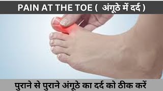 Pain At The Toe  अंगूठे का दर्द को तुरंत ठीक करें  Treatment  Hindi [upl. by Wistrup]