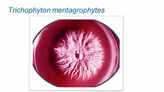 Superficial Fungal Infections Dermatophytes Part 2 Hot Topic [upl. by Loats16]