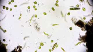 Wimpertierchen  Ciliophora  Hypotrichida  Ciliata  microorganisms under microscope [upl. by Rolan]