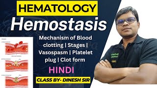 Hemostasis  Mechanism of Blood clotting  Stages  Vasospasm  Platelet plug  Blood clot  Hindi [upl. by Ioyal]