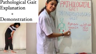 Pathological Gait  Exercise Therapy  Types Explained  physiotherapy [upl. by Kevan699]