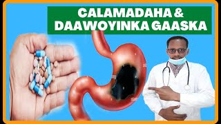 GAASKA CALOSHA amp MIDHICIRAHA CALAMALADAHA LAGU GARTO amp DAWEYNTISA PUPTIC ULCER DR MAHAMED LABAN [upl. by Adnerb]