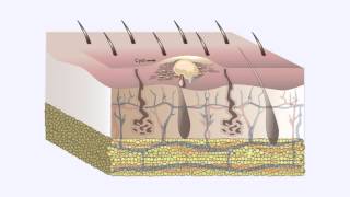 Common Skin Disorders [upl. by Erma479]