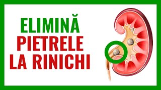 8 CEAIURI PENTRU PIETRE LA RINICHI 🌿💐🌳 Ceai pentru rinichi  ceai pentru nisip la rinichi [upl. by Aliak]