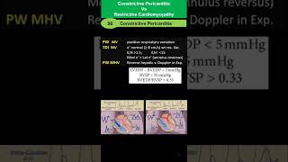 Constrictive Pericarditis vs Restrictive Cardiomyopathy [upl. by Zorina]