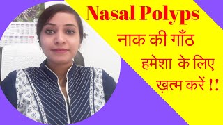 nasal polyps treatment  homeopathy for nasal polyps  nasal polyps homeopathic medicines  video [upl. by Isolda]