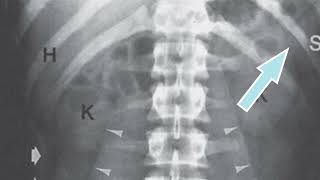 Abdominal X ray How to Read it [upl. by Nevag]