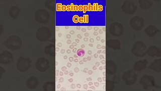 Eosinophils cells  Blood smear  Blood smear microscopy  shorts trendingshorts viral lab [upl. by Lectra]