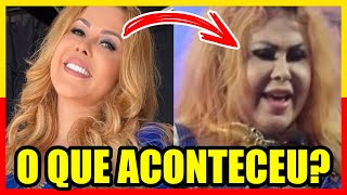 Saiba porque o ROSTO de Joelma está INCHADO E DEFORMADO [upl. by Reed]