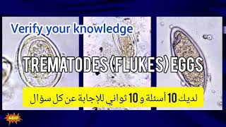 Trematodes identification training quiz أسئلة مختبرات طبية بيرسون فيو برومتريك أخصائي فني هيئة [upl. by Githens]