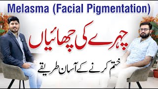 Melasma Causes  How To Treat Pigmentation  Dr Danial Ahmed with Dr AR Madha [upl. by Eelana722]