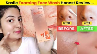 Cipla Saslic Facewash Review  Salicylic Acid Best Facewash  Remove BlackheadWhitehead amp Pimples 😱 [upl. by Iatnahs628]