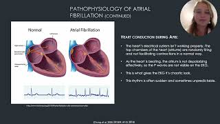 Afib presentation [upl. by Ellga715]