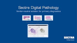 Auf einen Blick Sectras Digitale PathologieLösung für die Primärdiagnostik [upl. by Sileray]