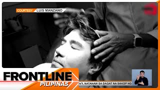 Luis Manzano nagpabiopsy nang may makapang lumalaking umanoy nunal sa ulo  Frontline Pilipinas [upl. by Naivart242]