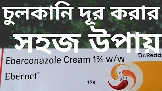 চুলকানি দূর করার সহজ উপায় Ebernet Cream [upl. by Cyrano]