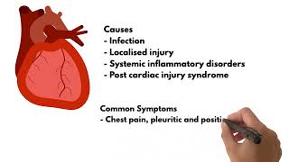 ECG changes Pericarditis [upl. by Claudetta963]