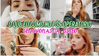 O QUE EU COMO EM 1 DIA de pósoperatório GENGIVOPLASTIA  OSTEOTOMIA [upl. by Aevin87]