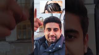 Hair regrowth treatment Available on Surgeryonline app hairregrowth hairrestoration viralvideo [upl. by Thursby]